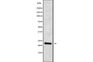 Western blot analysis IFNW1 using HUVEC whole cell lysates (IFNW1 antibody  (C-Term))