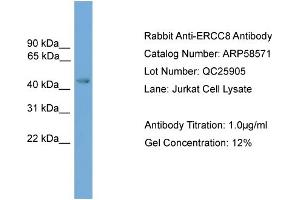 WB Suggested Anti-ERCC8  Antibody Titration: 0.