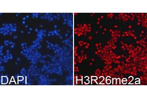 Immunofluorescence analysis of 293T cell using H3R26me2a antibody. (Histone 3 antibody  (H3R26me2))