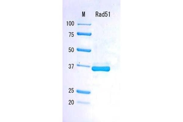 RAD51 Protein