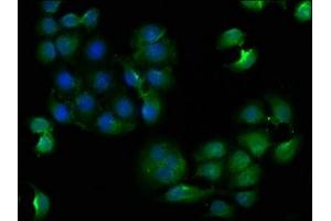 Immunofluorescence staining of A549 cells with ABIN7147850 at 1:133, counter-stained with DAPI. (CLTCL1 antibody  (AA 1423-1566))