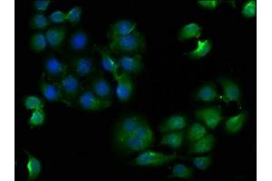 Immunofluorescence staining of A549 cells with ABIN7147850 at 1:133, counter-stained with DAPI.