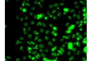 Immunofluorescence analysis of HeLa cells using SECISBP2 antibody (ABIN5974073).