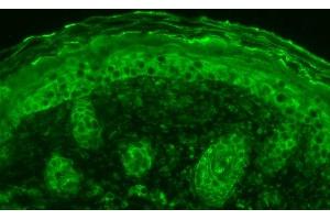 Immunohistochemistry analysis using Rabbit Anti-Calnexin Polyclonal Antibody (ABIN361826 and ABIN361827). (Calnexin antibody  (C-Term))