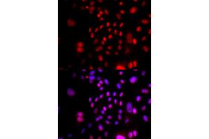 Immunofluorescence analysis of U2OS cells using RFC4 antibody (ABIN5973195). (RFC4 antibody)