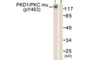 Western blot analysis of extracts from HepG2 cells, using PKD1/PKC mu (Phospho-Tyr463) Antibody. (PKC mu antibody  (pTyr463))