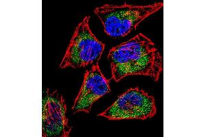 Fluorescent confocal image of Hela cell stained with SIX5 Antibody (Center) (ABIN656668 and ABIN2845908).