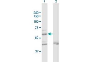 Western Blot analysis of ZNF92 expression in transfected 293T cell line by ZNF92 MaxPab polyclonal antibody. (ZNF92 antibody  (AA 1-517))