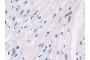 Immunohistochemistry (IHC) image for anti-Poly (ADP-Ribose) Polymerase 1 (PARP1) (AA 661-881) antibody (ABIN7439663)