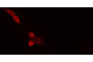 ABIN6274665 staining HepG2 cells by IF/ICC. (DNAJB4 antibody  (Internal Region))