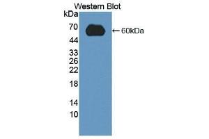 Western Blotting (WB) image for anti-Low Density Lipoprotein Receptor (LDLR) (AA 263-509) antibody (ABIN1868940) (LDLR antibody  (AA 263-509))