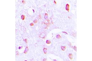 Immunohistochemical analysis of PERK staining in human brain formalin fixed paraffin embedded tissue section. (PERK antibody  (N-Term))