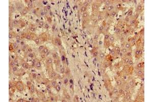 Immunohistochemistry of paraffin-embedded human liver tissue using ABIN7142793 at dilution of 1:100