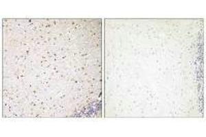 Immunohistochemistry analysis of paraffin-embedded human brain tissue, using PAK7 antibody. (PAK7 antibody  (C-Term))