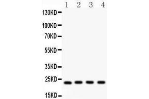 Anti- BAK Picoband antibody, Western blotting All lanes: Anti BAK  at 0. (BAK1 antibody  (AA 22-211))