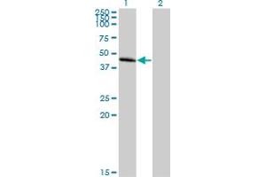 Western Blot analysis of CCBP2 expression in transfected 293T cell line by CCBP2 MaxPab polyclonal antibody. (CCBP2 antibody  (AA 1-384))