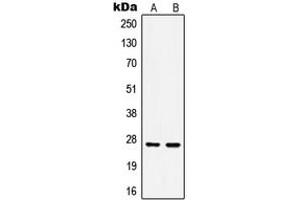Western blot analysis of HSP27 (pS15) expression in HeLa Anisomycin-treated (A), MCF7 (B) whole cell lysates. (HSP27 antibody  (N-Term, pSer15))