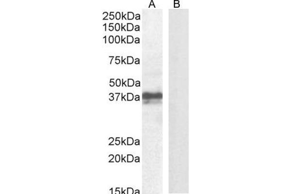 FOXI3 antibody  (Internal Region)