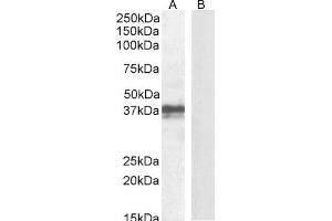 ABIN625827 (1 μg/mL) staining of Mouse Skin lysate (A) + peptide (B) (35 μg protein in RIPA buffer). (FOXI3 antibody  (Internal Region))
