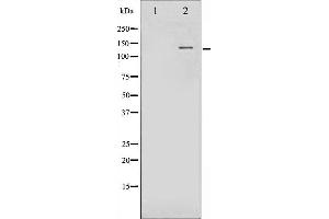 Western blot analysis of FGFR1 phosphorylation expression in Insulin treated 293 whole cell lysates,The lane on the left is treated with the antigen-specific peptide.