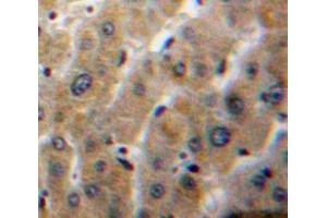 IHC-P analysis of Liver tissue, with DAB staining. (PLA1A antibody  (AA 148-295))