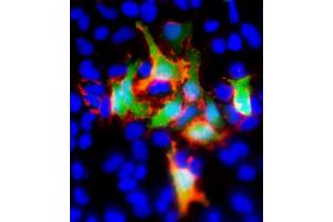 Immunofluorescent analysis of GFP using either natural fluorescence (green) or an GFP antibody (red) in Hela(human cervical epithelial adenocarcinoma cell line) cells transfected with GFP recombinant protein. (GFP Tag antibody)