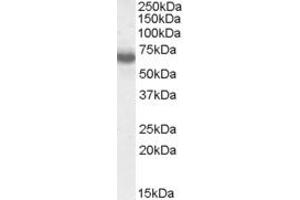 Western Blotting (WB) image for anti-IKAROS Family Zinc Finger 1 (Ikaros) (IKZF1) (AA 436-450) antibody (ABIN490467) (IKZF1 antibody  (AA 436-450))