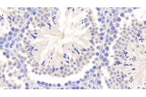 Detection of a1BG in Mouse Testis Tissue using Polyclonal Antibody to Alpha-1-B-Glycoprotein (a1BG) (A1BG antibody  (AA 313-512))