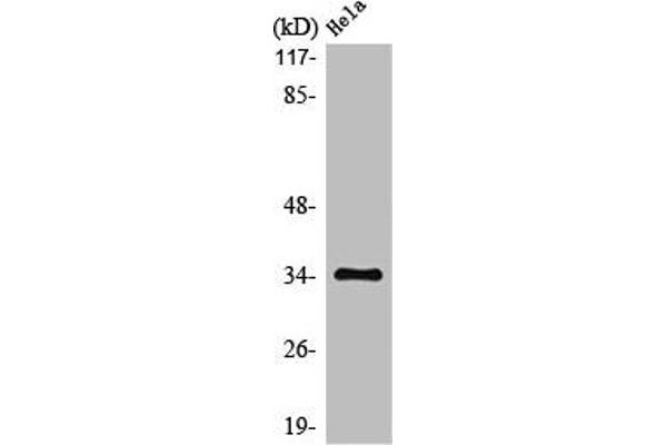 MC2R Antikörper  (C-Term)