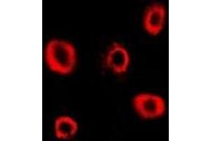 Immunofluorescent analysis of RRM2 staining in Hela cells. (RRM2 antibody)