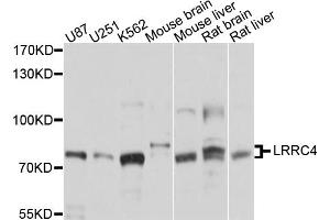 Western blot analysis of extracts of various cell lines, using LRRC4 antibody. (LRRC4 antibody)