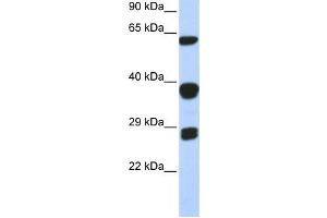 Western Blotting (WB) image for anti-Small Nuclear Ribonucleoprotein Polypeptides B and B1 (SNRPB) antibody (ABIN2458499) (SNRPB antibody)