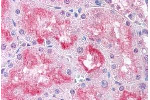 Human Kidney (formalin-fixed, paraffin-embedded) stained with USP33 antibody ABIN213600 at 5 ug/ml followed by biotinylated goat anti-rabbit IgG secondary antibody ABIN481713, alkaline phosphatase-streptavidin and chromogen. (USP33 antibody  (Internal Region))