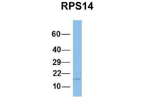 Host:  Rabbit  Target Name:  RPS14  Sample Type:  Human Fetal Brain  Antibody Dilution:  1. (RPS14 antibody  (Middle Region))