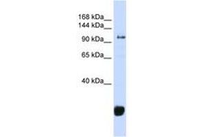 Image no. 1 for anti-F-Box Protein 10 (FBXO10) (AA 324-373) antibody (ABIN6743262) (FBXO10 antibody  (AA 324-373))