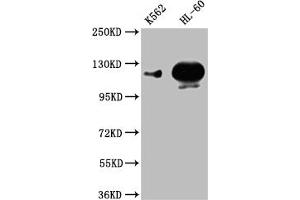 Western Blot Positive WB detected in: K562 whole cell lysate,HL-60 whole cell lysate All lanes: POTEE antibody at 1:1000 Secondary Goat polyclonal to rabbit IgG at 1/50000 dilution Predicted band size: 122 kDa Observed band size: 122 kDa (POTEE antibody  (AA 435-606))