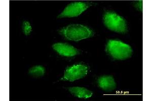 Immunofluorescence of monoclonal antibody to PLGLB2 on HeLa cell. (PLGLB2 antibody  (AA 21-96))