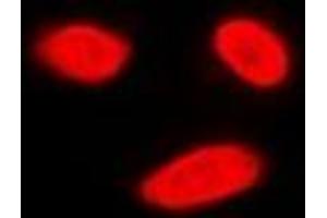 Immunofluorescent analysis of ERK5 staining in K562 cells. (MAPK7 antibody)