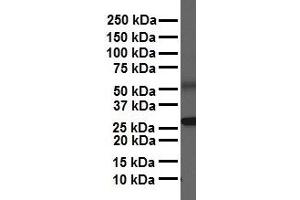 WB Suggested Anti-NR5A1 antibody Titration: 1 ug/mL Sample Type: Human heart (NR5A1 antibody  (Middle Region))