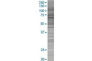 DPYSL4 transfected lysate. (DPYSL4 293T Cell Transient Overexpression Lysate(Denatured))