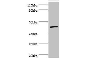 Western blot All lanes: Interleukin-13 receptor subunit alpha-2 antibody at 5 μg/mL + Hela whole cell lysate Secondary Goat polyclonal to rabbit IgG at 1/10000 dilution Predicted band size: 44 kDa Observed band size: 44 kDa (IL13RA2 antibody  (AA 27-343))