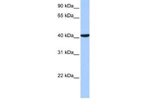 WB Suggested Anti-CC2D1B Antibody Titration: 0. (CC2D1B antibody  (C-Term))