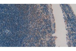 Detection of CHEM in Mouse Spleen Tissue using Polyclonal Antibody to Chemerin (CHEM) (Chemerin antibody  (AA 21-155))