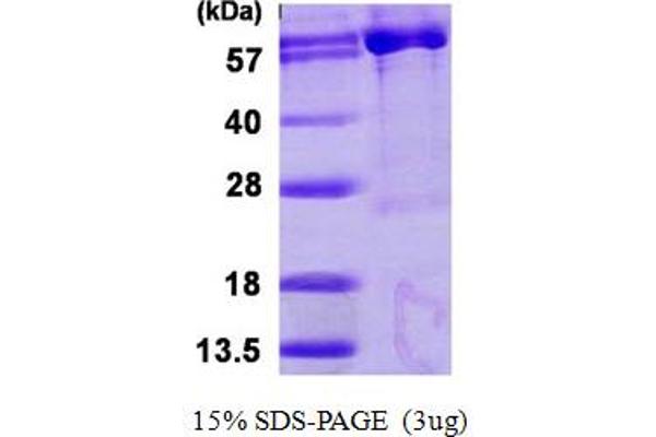 PAPSS1 Protein (AA 24-624) (His tag)