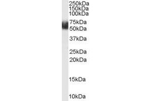 ABIN185700 (1µg/ml) staining of Human Adipose lysate (35µg protein in RIPA buffer). (FBXL3 antibody  (N-Term))