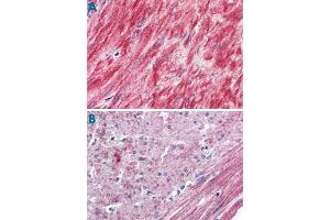 Immunohistochemistry (Formalin/PFA-fixed paraffin-embedded sections) of human prostate, smooth muscle (A) and human colon, smooth muscle (B) with ELTD1 polyclonal antibody . (ELTD1 antibody  (N-Term))