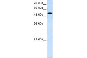 Western Blotting (WB) image for anti-Solute Carrier Family 25 (Mitochondrial Carrier, Phosphate Carrier), Member 25 (SLC25A25) antibody (ABIN2462730)