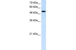 Western Blotting (WB) image for anti-Solute Carrier Family 25 (Mitochondrial Carrier, Phosphate Carrier), Member 25 (SLC25A25) antibody (ABIN2462730)