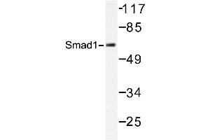 Image no. 2 for anti-SMAD, Mothers Against DPP Homolog 1 (SMAD1) antibody (ABIN272123) (SMAD1 antibody)