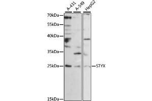 Western blot analysis of extracts of various cell lines, using STYX antibody (ABIN6293959) at 1:1000 dilution. (STYX antibody)